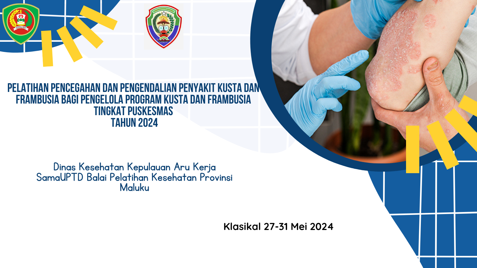 Pelatihan Pencegahan dan Pengendalian Penyakit Kusta dan Frambusia Bagi Pengelola Program Kusta dan Frambusia Tingkat Puskesmas