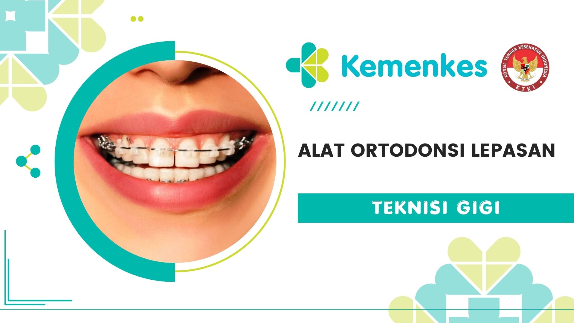 Alat Ortodonsi Lepasan (Teknisi Gigi)