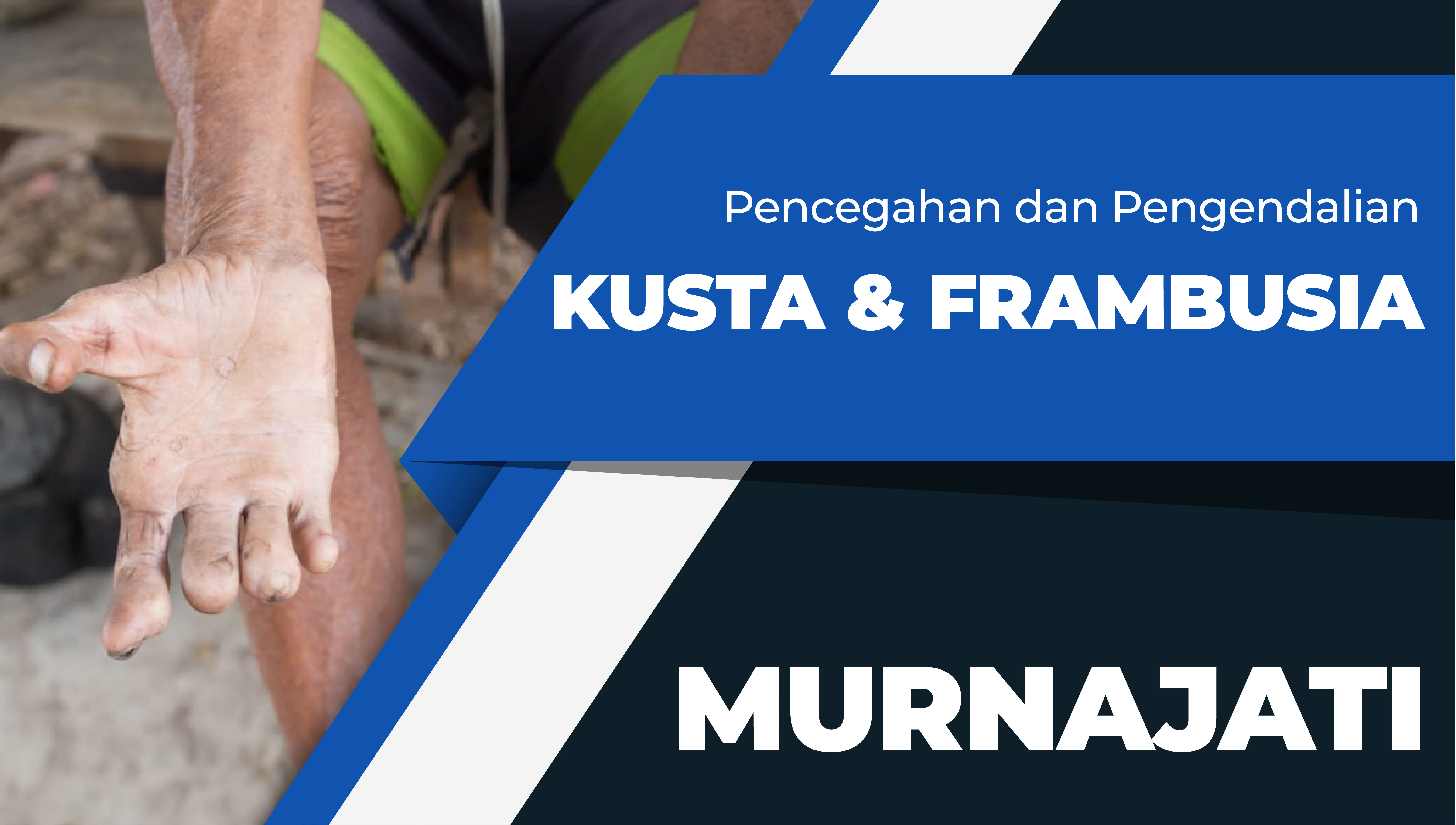 Pelatihan Pencegahan dan Pengendalian Penyakit Kusta dan Frambusia Bagi Pengelola Program Kusta dan Frambusia Tingkat Puskesmas Angkatan 1